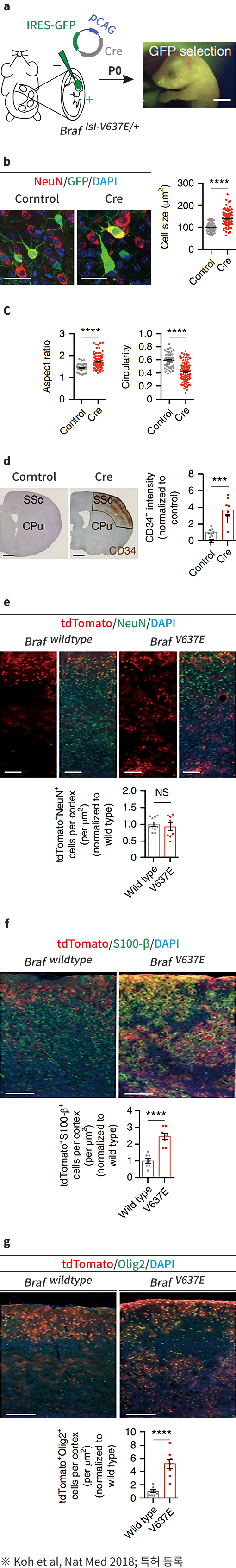 소아 뇌종양 모델 관련 이미지